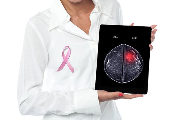 Radiation oncology for breast care