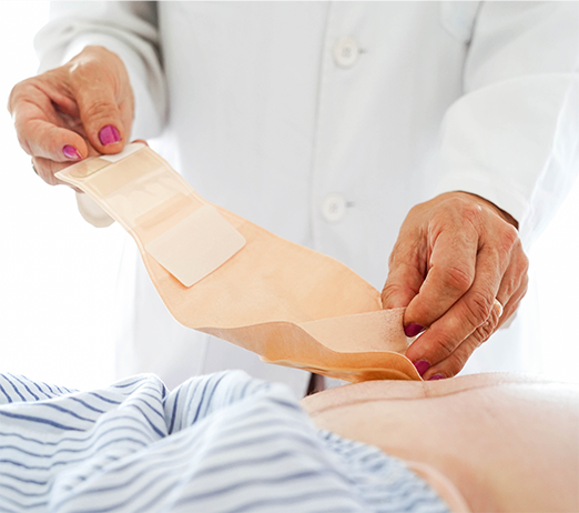 Stoma clinic support services