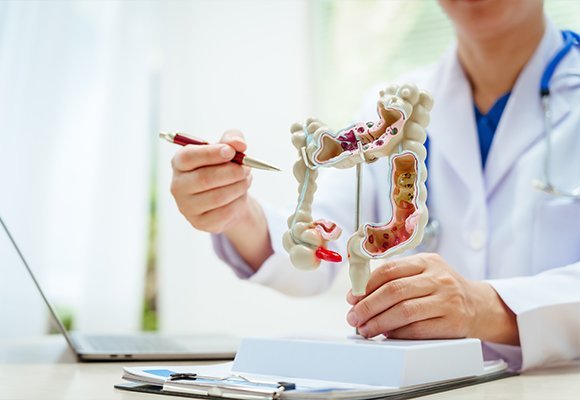 Colon and rectum digestive disease services