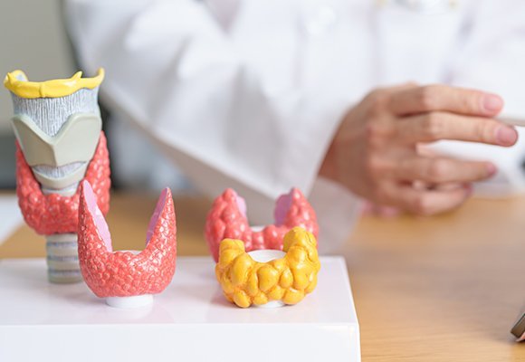 Thyroid Nodules