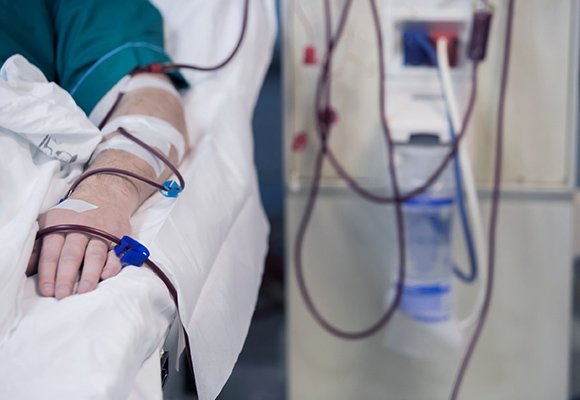 Understanding dialysis