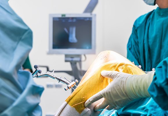 Orthopedics key procedures